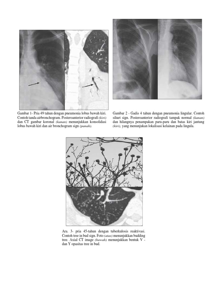 Gambar Radiologi | PDF