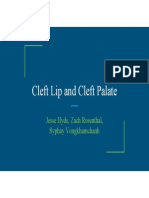 cleft lip and cleft palate