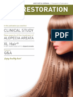 Estudio XL HAIR - Alopecia Areata