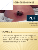 s.12 Omphalitis Pada Bayi Baru Lahir