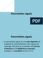 Pancreatites Aigues