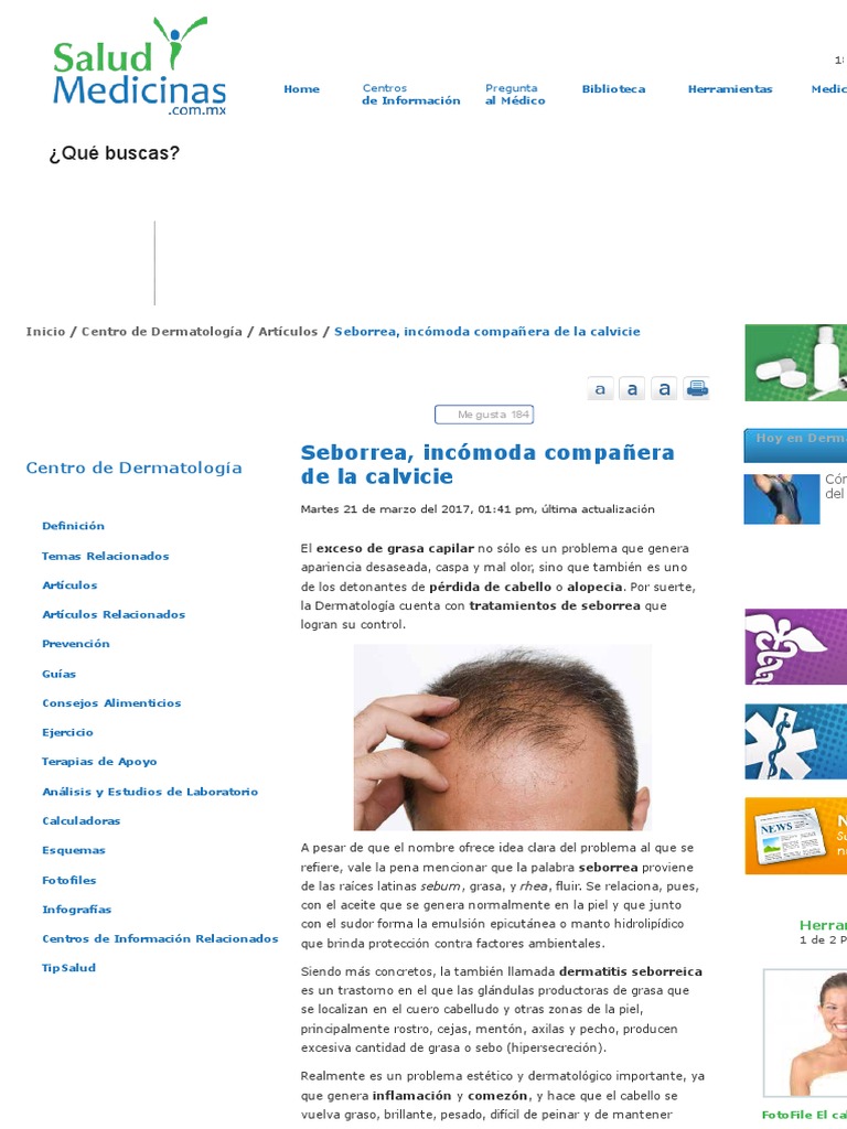 Seborrea, Caída Del Cabello Por Excesiva Producción de Grasa - SyM PDF ...