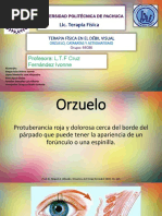 Orzuelo Cataratas Astigmatismo (1)