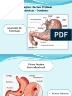 Ulcera Gastroduodenal: Factores, Síntomas y Tratamiento