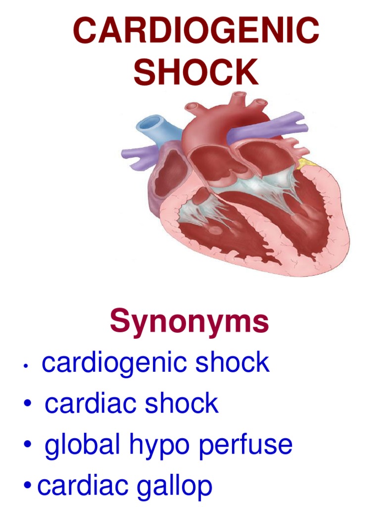Understanding Cardiogenic Shock | PDF | Shock (Circulatory) | Heart Failure