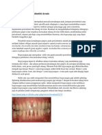 Pengertian Periodontitis Kronis