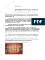 Pengertian periodontitis kronis dan pengobatannya