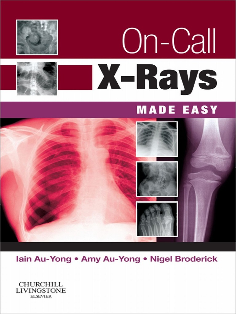 OnCall XRays Made Easy_nodrm Radiology Medicine