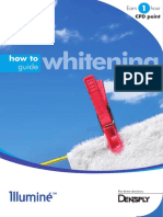 How to Guide Whitening