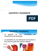 Gastritis y Duodenitis