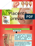 Placenta Previa 1