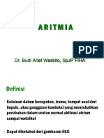 aritmia