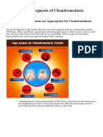 Yoga, Braces, Prognosis of Chondromalacia Patella