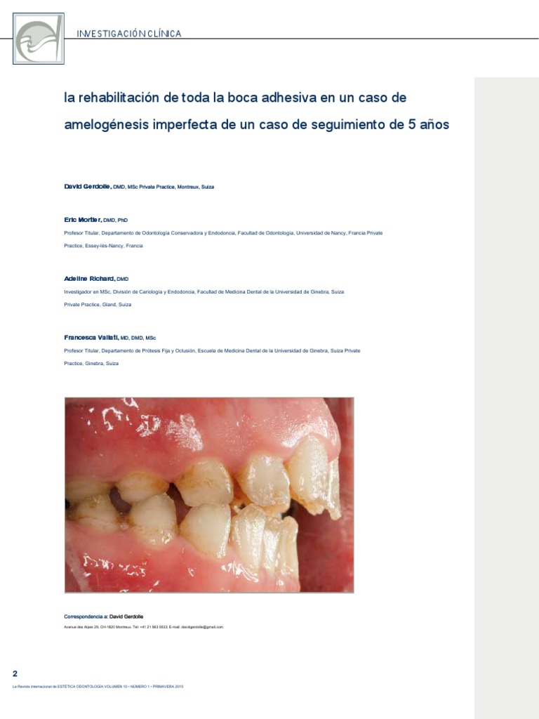 Amelogenesis Imperfecta