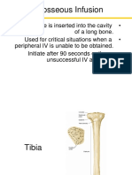 Intraosseous Infusion