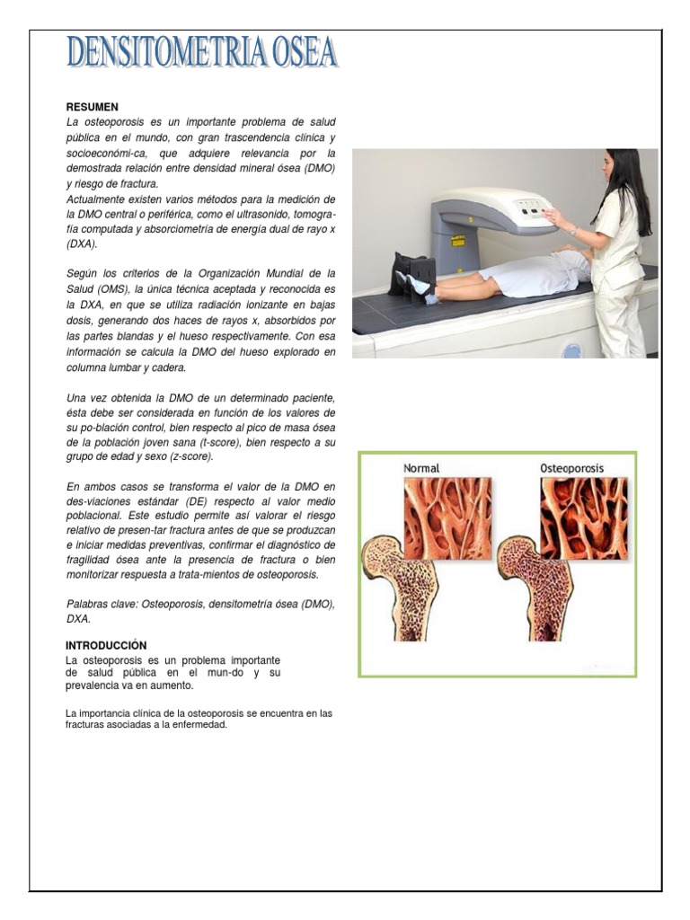 densitometria-osea-pdf-osteoporosis-hueso
