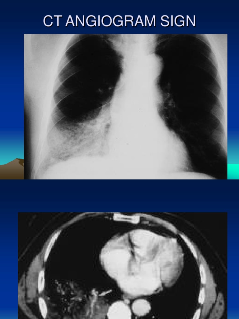 Key Radiology Signs Explained | PDF | Knee | Elbow