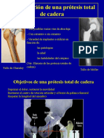 2- Tecnicas Para Protesis Totales de Cadera