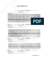 Membaca EKG Latihan 30 Kasus