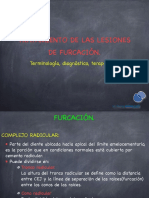 Clase 6 Tratamiento Lesiones Furcación