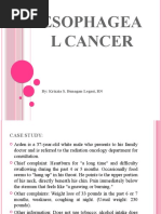 Esophagea L Cancer: By: Krizzia S. Bunagan-Legasi, RN