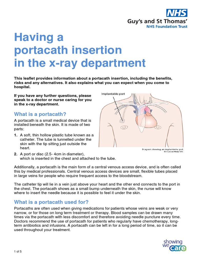 Having a portacath insertion in the xray department Medicine