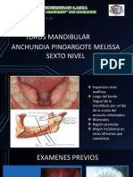 Torus Mandibular