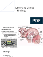 Brain Tumor and Clinical Findings