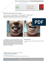 Article in Press: Raynaud's Phenomenon of The Tongue