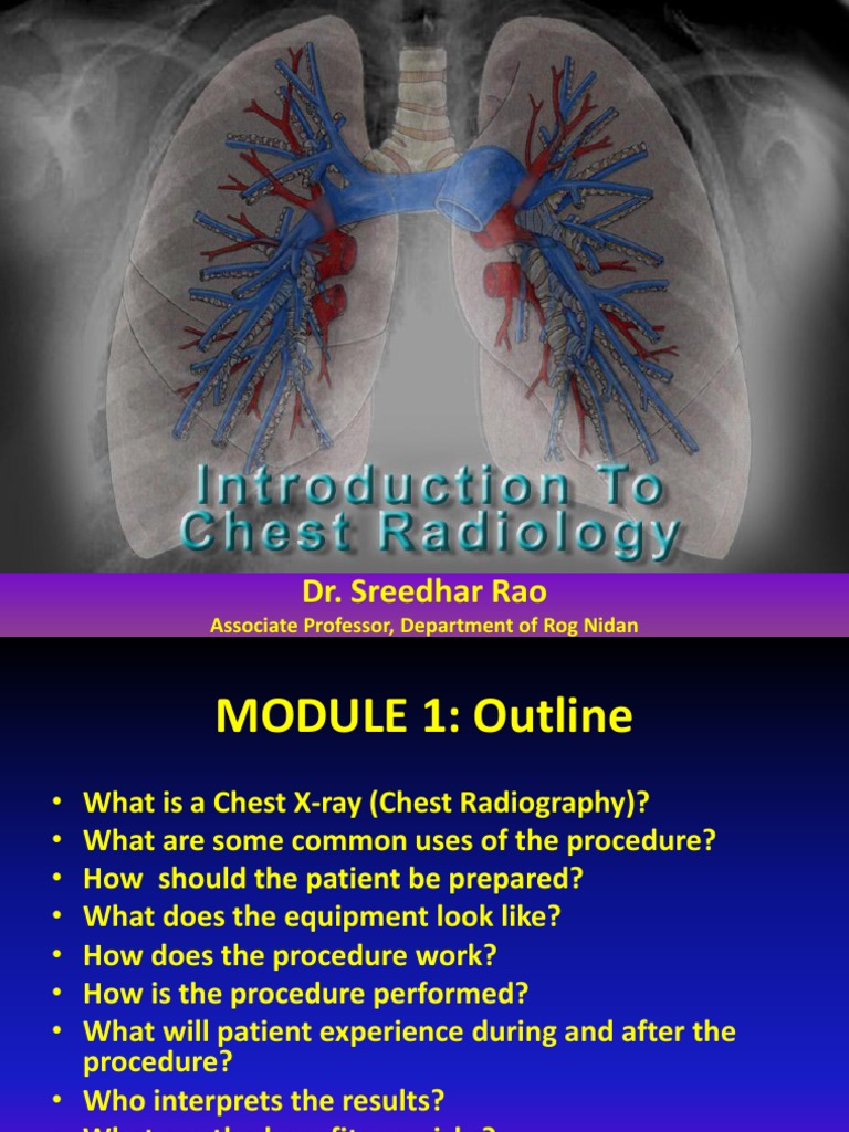 Chest X-ray Guide for Medical Students | PDF | Lung | X Ray