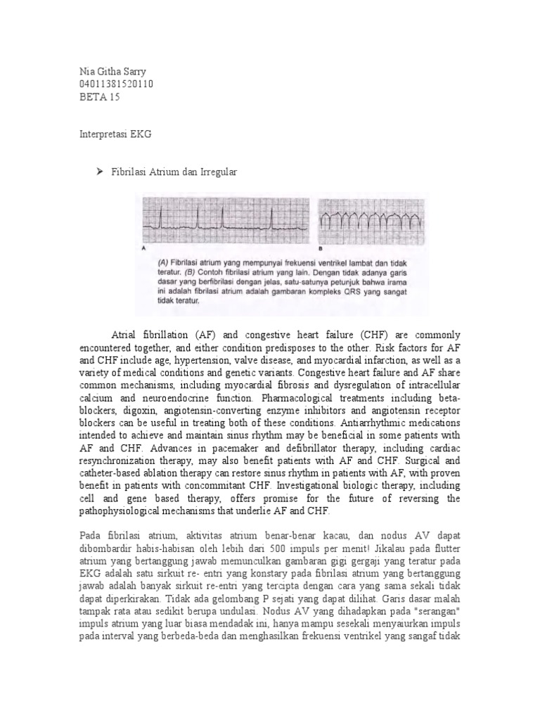 Download 94+ Gambar Ekg Gagal Jantung Paling Bagus Gratis HD