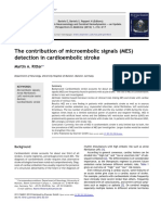 50 NS Microembolic Signals