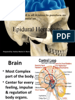 Epidural Hematoma: A Slip and Fall Is All It Takes To Puncture An Artery and Cause An..