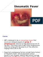 Acute Rheumatic Fever'13