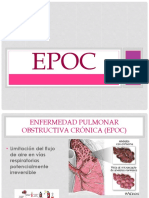 EPOC Rehabilitación