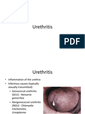 Gyertyák urethritis és prosztatitis