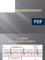 Elektrokardiografi