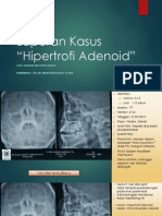 Laporan Kasus Hipertrofi Adenoid
