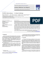 Respiratory Medicine Case Reports: Regina Monteiro, José Carlos Carneiro, Claúdia Costa, Raquel Duarte