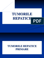 Tumori hepatice Romana 2017.pptx