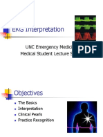 EKG Interpretation