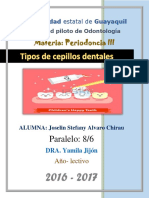 Tipos de Cepillos