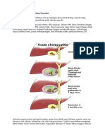 Kolesistitis (Radang Kandung Empedu)