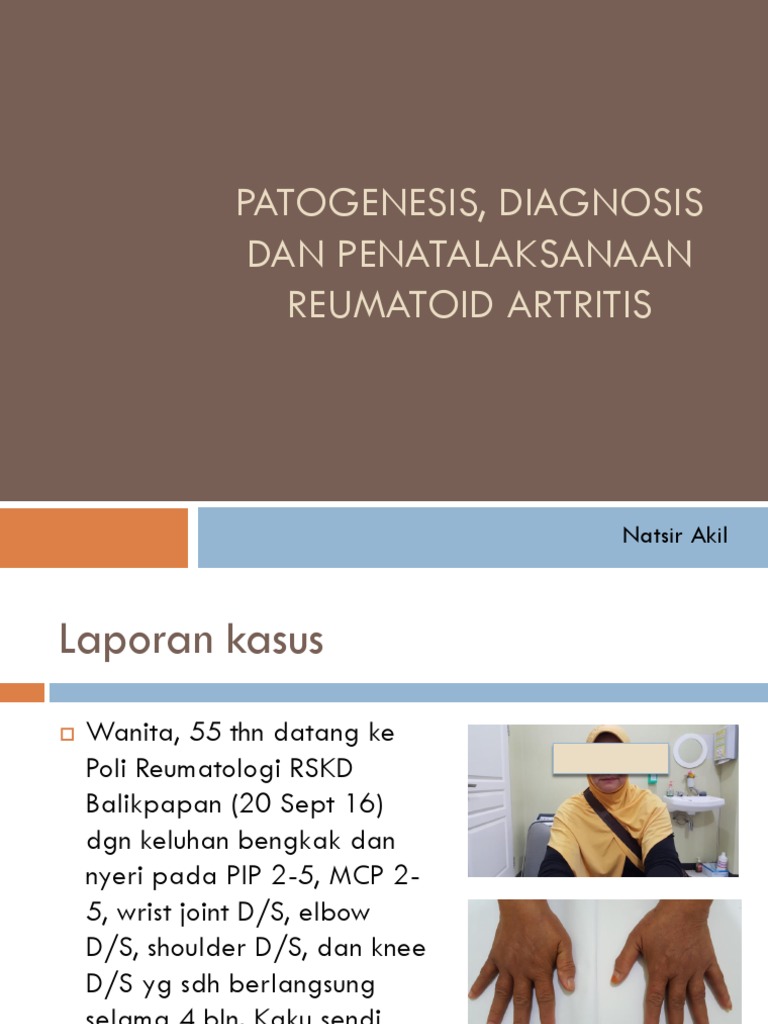 Rheumatoid arthritis essay picture