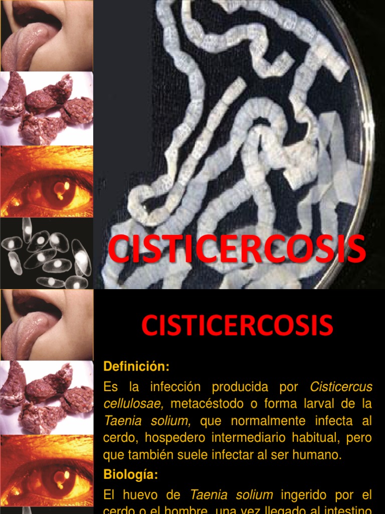 14.2. Cisticercosis - Mc. José Barletta Villarán | PDF | Especialidades ...