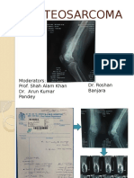 Osteosarcoma: Dr. Roshan Banjara Moderators: Prof. Shah Alam Khan Dr. Arun Kumar Pandey