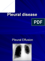 Pleural Effusion