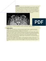 Anatomía Del Nervio Óptico