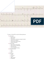 EKG