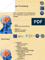 Medical Image Processing: H&Y Compilant For PD Diagnosis and Prognosis Using EPI and FA Images